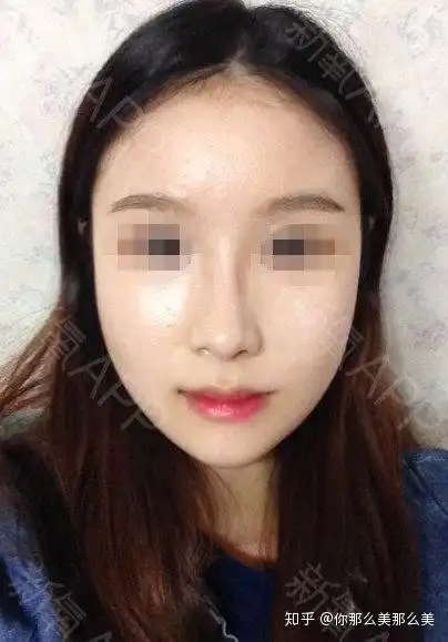 面部显老要怎么办
