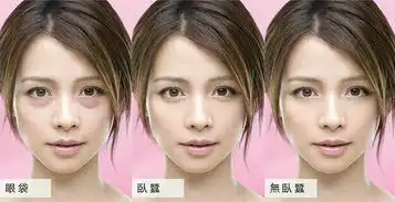 黑眼圈,眼袋统统不要
