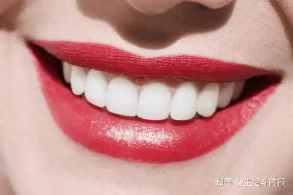 牙齿为什么容易发黄教你这一招,牙齿很快就变白
