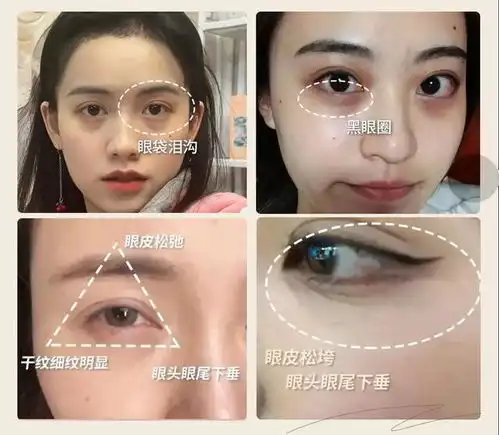 经常熬夜什么眼霜好用这5款抗老紧致淡化黑眼圈,告别熊猫眼
