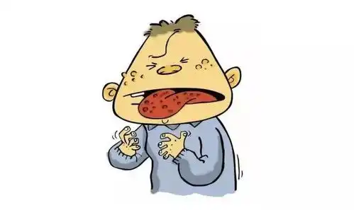 口腔溃疡反反复复,根据病情,用对药预防才是关键
