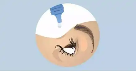 如何正确使用眼药水
