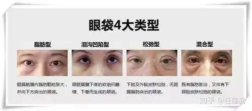 为什么我每天睡够了8小时,黑眼圈和眼袋还是很重啊
