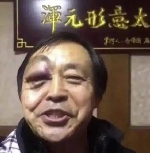 马保国手心肉球是太极总开关郭晨冬瘤子雷雷心包经外泄
