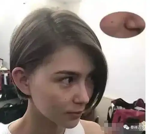 面部精雕之眼部
