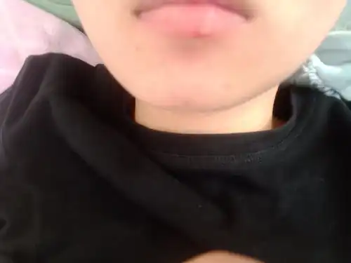 我早上涂了口红,下午嘴唇子就长了水泡是口红过期...
