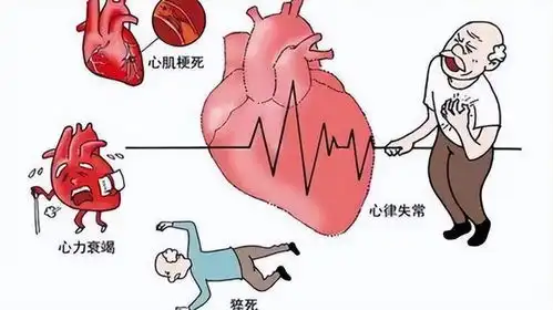冠心病最怕发展为心衰提醒降低心衰风险,关键要做好这2件事
