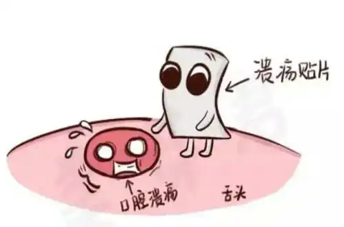口腔溃疡很嚣张,科学预防要知道
