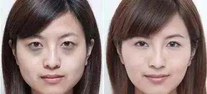 你还用手指涂抹眼霜真是浪费眼霜,难怪黑眼圈这么重
