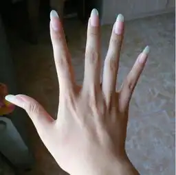 手脱皮红肿起水泡怎么办这植物涂手,手变嫩滑光洁白皙
