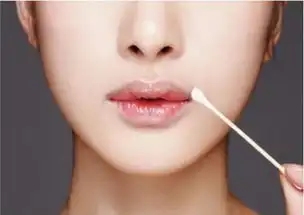 嘴唇干燥咋整,快瞧瞧这些攻略
