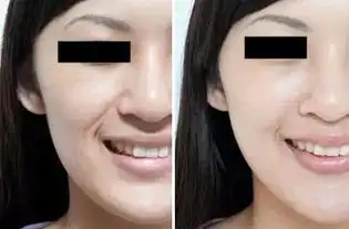 你的法令纹能刷卡了吗

