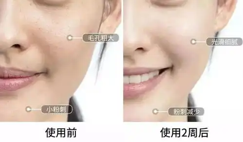 瑞丽美妆大赏营养面膜大评测15天换脸,每天不到一杯奶茶钱,王鸥都种草了
