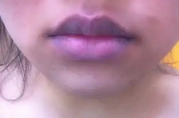 心脏不错的人,身体没有3痛2紫,若你也是,恭喜心脏挺好牙痛
