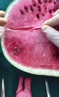 谁知道抖音里那个用水果蔬菜做手术的小姐姐的抖音id