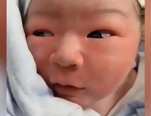 孕妈吃龙虾把胎宝宝辣到早产,宝宝出生后上火模样笑翻网友
