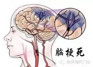 我用图片告诉你,痛风不是一个病,是一串病
