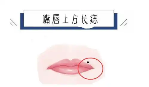 身上四颗麻烦痣,花钱没节制,容易被小人算计,一生难脱贫财经头条
