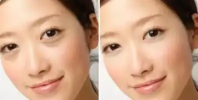 你的黑眼圈,不是无药可救皮肤科医生揭开眼霜去不了黑眼圈的秘密
