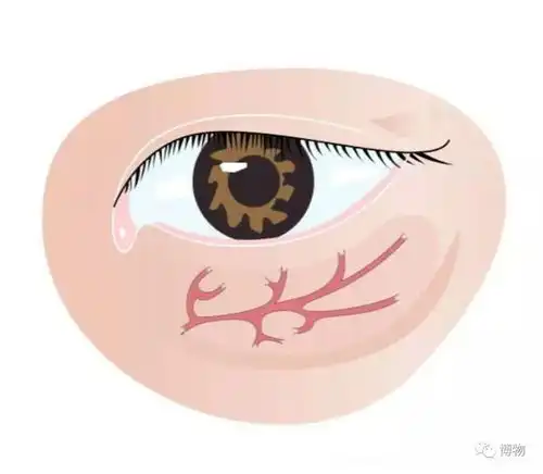 郑重声明,黑眼圈不是迷人的卧蚕
