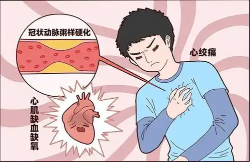 为什么劳累一点心脏就不舒服合源单硝酸异山梨酯缓释胶囊解答
