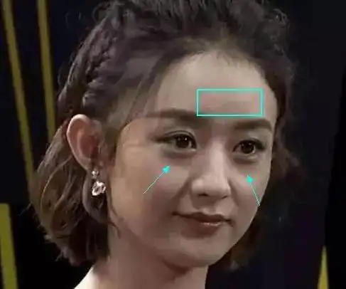 尺度医疗整形关晓彤古力娜扎再漂亮也跳不过这些坑
