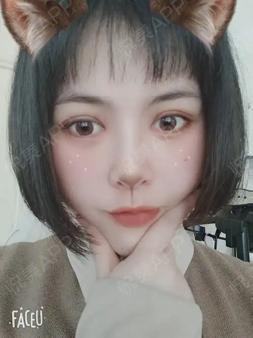今天已经术后第七天了去医院拆了线,拆线之前就很激动...眼部多项悦美整形
