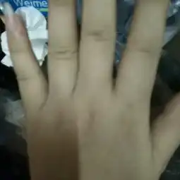 请问有孕妈水肿的吗我最近手老是水肿很利害,但脚却没有水肿有知道原因吗
