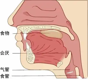 嗓子疼差点要了他的命专家出现这几种喉咙痛,千万别拖
