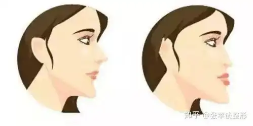 鼻综合的七大功效,你知道几个
