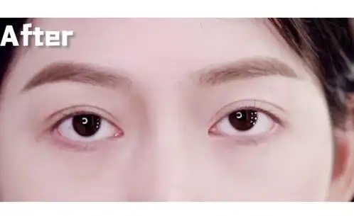 双眼皮贴红黑榜今天是避坑种草教程一条龙服务
