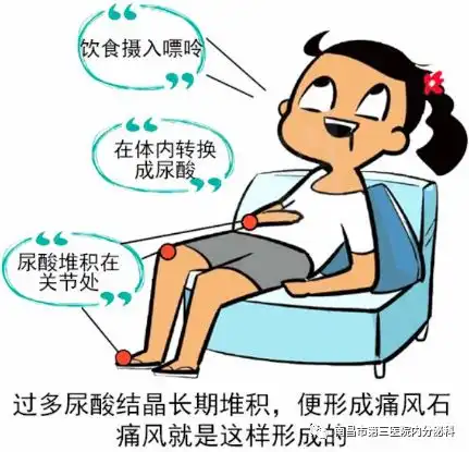 泌语科普丨乘风破浪的80后90后会痛风吗
