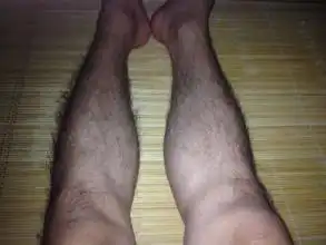 拔腿毛会怎么样