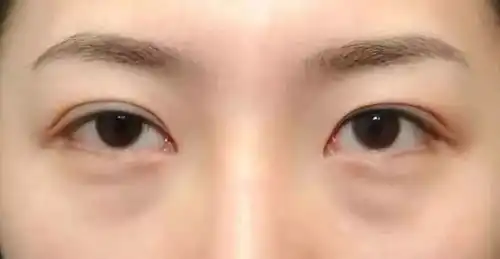 神奇430年马应龙非遗中药眼膜,一贴敷走黑眼圈,大眼袋,细纹年轻10岁成分
