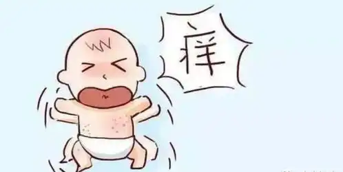 关于宝宝湿疹要注意的问题,大汇总
