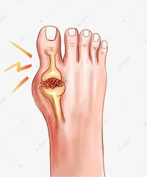 脚关节痛风疼痛素材图片免费下载千库网
