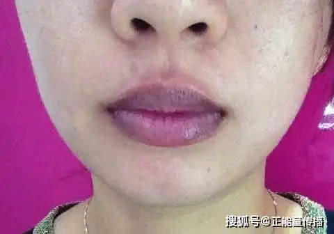 心脏不好,嘴唇会有这3种变化,如果没有,说明心脏还算健康症状

