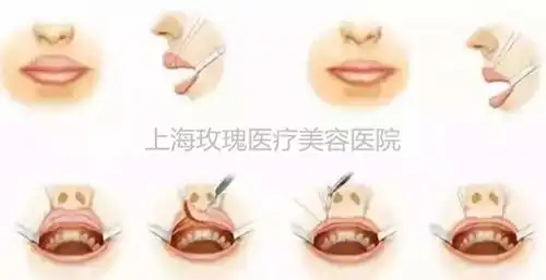 唇形影响颜值,颜值影响一切
