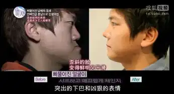 韩国双胞胎整形逆袭丑女大变身6367451
