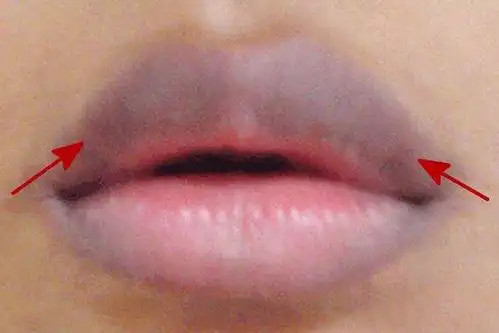 嘴唇发紫竟然要做开颅手术快照镜子看看自己的嘴唇是什么颜色
