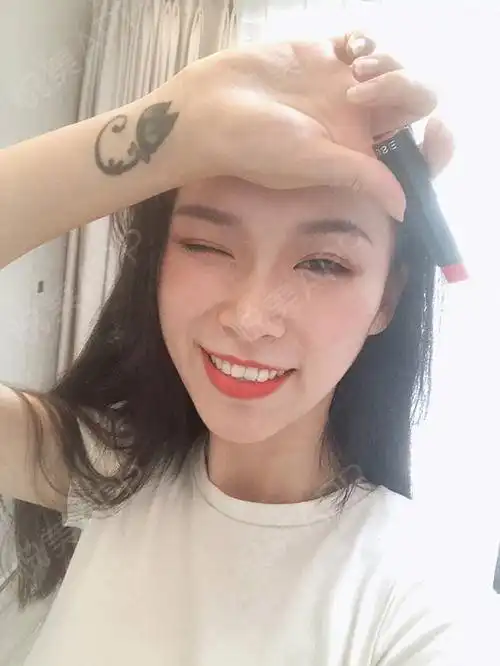 半个月咯,没有什么不适哈就是偶尔脸会有紧绷感,...紧致提升悦美整形
