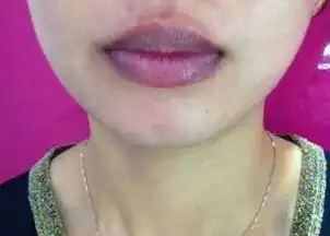 嘴唇发紫的原因是什么嘴唇的颜色可预示你身体的健康状况
