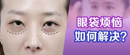 科普向一个标准的去眼袋手术术后表现是怎样的

