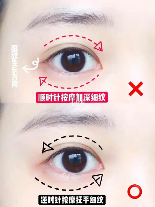 黑眼圈

