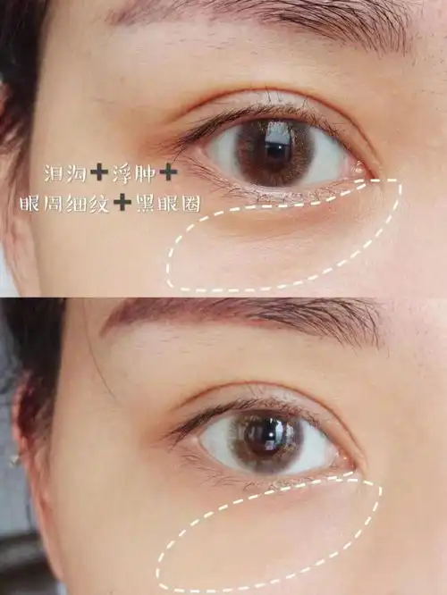 抗老眼霜哪个品牌比较好这6款抗皱眼霜入股不亏
